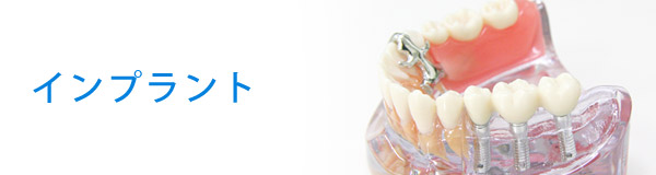 インプラント